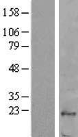 Fucose mutarotase (FUOM) Human Over-expression Lysate