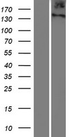 ITIH6 Human Over-expression Lysate