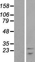 SNRPB Human Over-expression Lysate