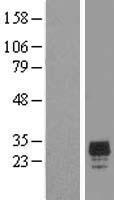 CHMP2A Human Over-expression Lysate