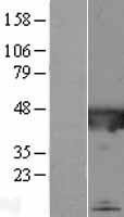 CATIP Human Over-expression Lysate