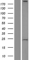 LRRK2 Human Over-expression Lysate
