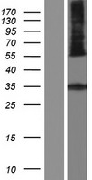 HSD11B1L Human Over-expression Lysate