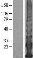 KRTAP12-4 Human Over-expression Lysate