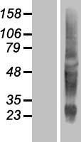 KRTAP10-11 Human Over-expression Lysate