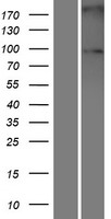 Sulfatase 2 (SULF2) Human Over-expression Lysate