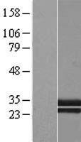 CTRP1 (C1QTNF1) Human Over-expression Lysate