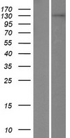 TDRD1 Human Over-expression Lysate