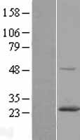 RAB6A Human Over-expression Lysate