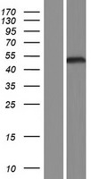LHX6 Human Over-expression Lysate