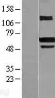 PRMT4 (CARM1) Human Over-expression Lysate