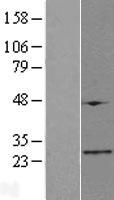 ATPSCKMT Human Over-expression Lysate