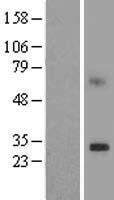 PEDS1 Human Over-expression Lysate