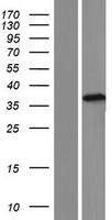 TEPP Human Over-expression Lysate