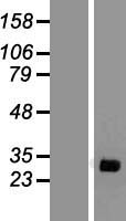SCN1B Human Over-expression Lysate