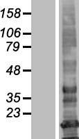 LHFPL3 Human Over-expression Lysate