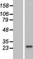 RPE Human Over-expression Lysate