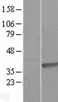 DHRS9 Human Over-expression Lysate