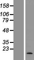 Osteocalcin (BGLAP) Human Over-expression Lysate