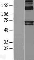 ALAS1 Human Over-expression Lysate