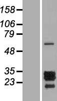 Parathyroid hormone related protein (PTHLH) Human Over-expression Lysate