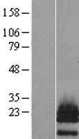 Parathyroid hormone related protein (PTHLH) Human Over-expression Lysate