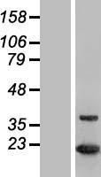 MTH1 (NUDT1) Human Over-expression Lysate