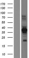 HOMER2 Human Over-expression Lysate