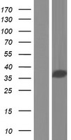 CC137 (CCDC137) Human Over-expression Lysate