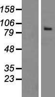 THSD1 Human Over-expression Lysate
