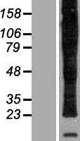 PLP1 Human Over-expression Lysate