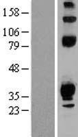 TEPP Human Over-expression Lysate