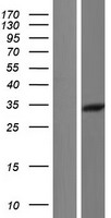 CNN2 Human Over-expression Lysate
