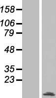splicing factor 1 (SF1) Human Over-expression Lysate