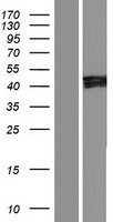 IKIP (IKBIP) Human Over-expression Lysate