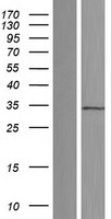 FAM86A (EEF2KMT) Human Over-expression Lysate