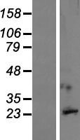 Neuronal membrane glycoprotein M6 a (GPM6A) Human Over-expression Lysate
