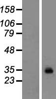 Neuronal membrane glycoprotein M6 a (GPM6A) Human Over-expression Lysate