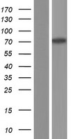 CACNB2 Human Over-expression Lysate