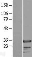 FHL2 Human Over-expression Lysate