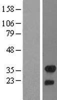 FHL2 Human Over-expression Lysate