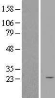 SERTAD3 Human Over-expression Lysate