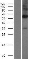 DPAGT1 Human Over-expression Lysate