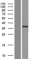 RNF90 (TRIM7) Human Over-expression Lysate