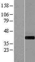 GIPC (GIPC1) Human Over-expression Lysate