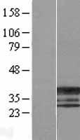 ERCC1 Human Over-expression Lysate