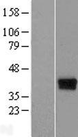 C17orf81 (ELP5) Human Over-expression Lysate