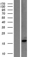 Myoglobin (MB) Human Over-expression Lysate