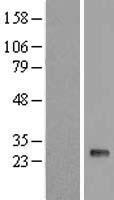 TMEM81 Human Over-expression Lysate