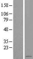 LOC284912 Human Over-expression Lysate